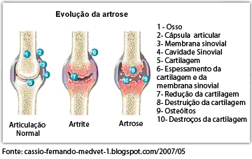 cod artrita articulara)